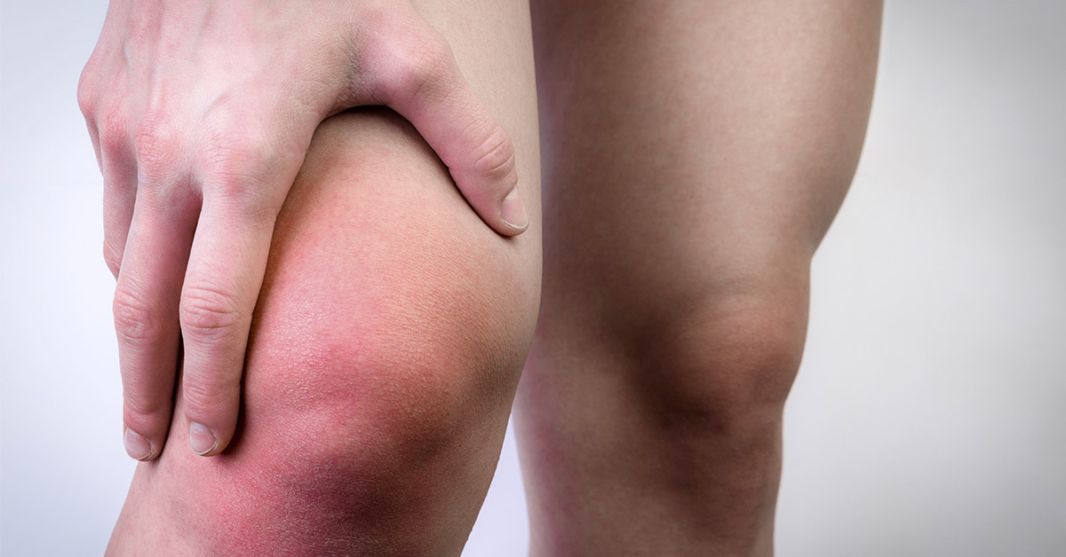 person placing hand on sore swollen knee