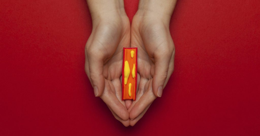 How to Recognize and Fight Clogged Arteries: Signs, Prevention, and Treatment Strategies - Featured image