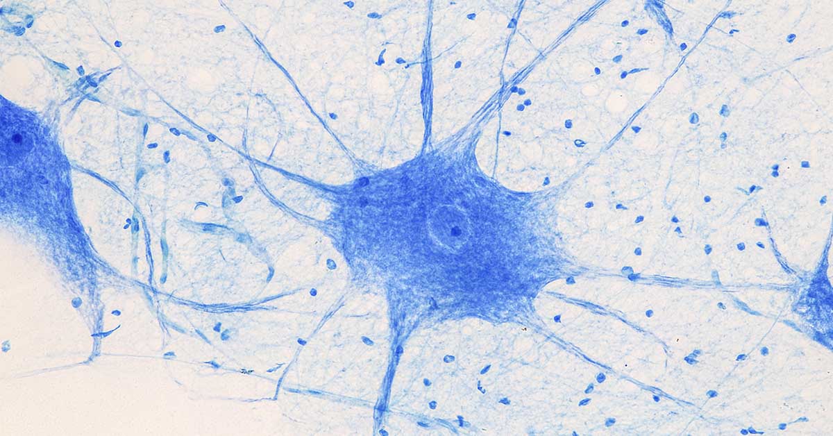 brain cells