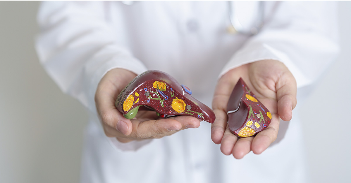 doctor holding model of a liver. Liver health concept