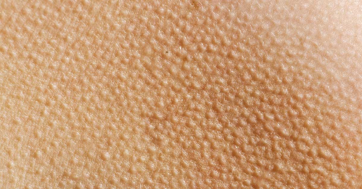 freeze branding body modification