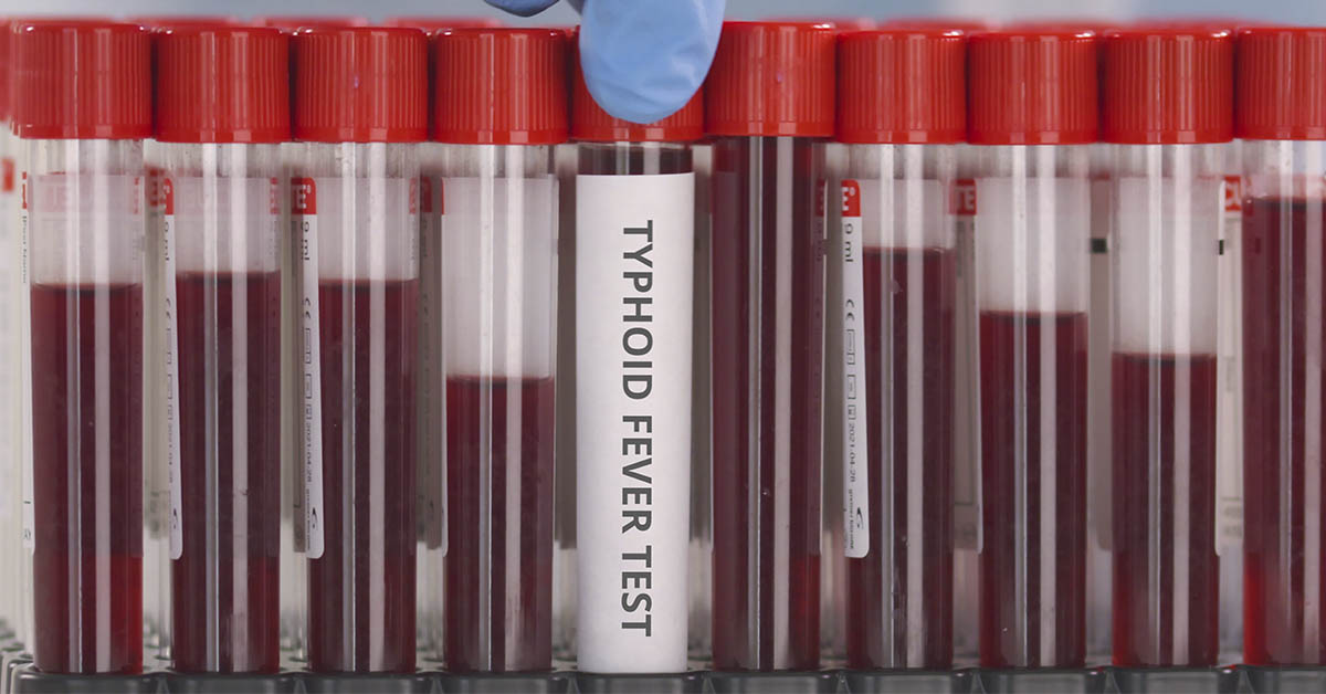 typhoid fever illness
