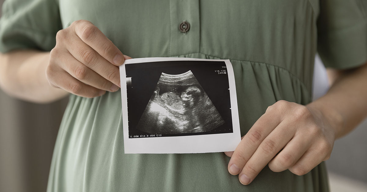 ultrasound image