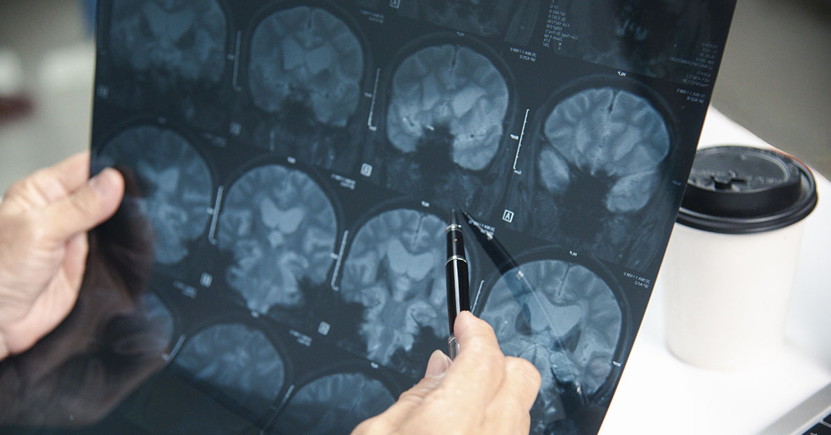 medical professional reviewing brain scans