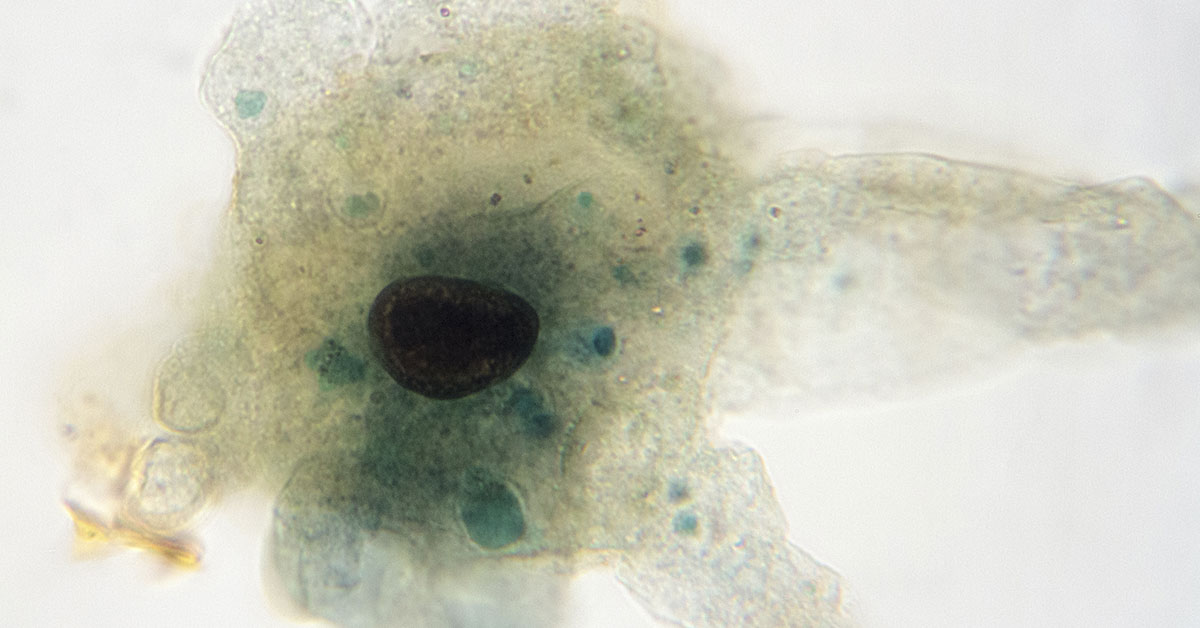 microscope view of Amoeba