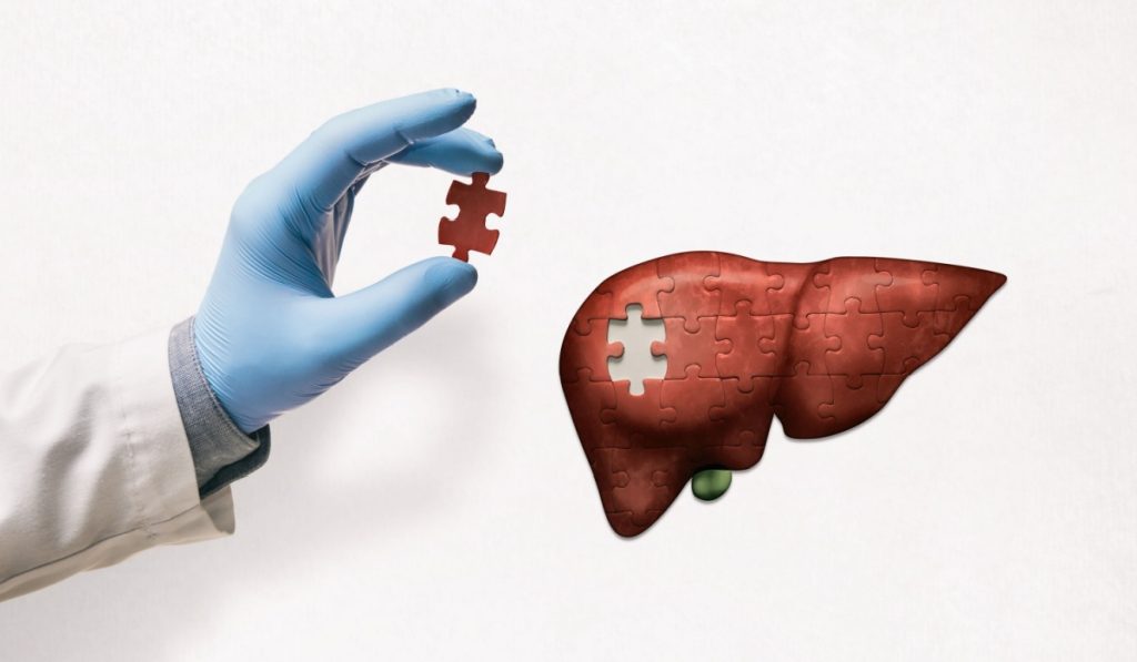 Puzzle with illustration of liver and doctor's hand with the missing piece of puzzle. Liver treatment concept.