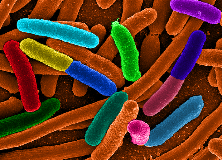 Microscopic view of E. coli bacteria that commonly cause urinary tract infections.