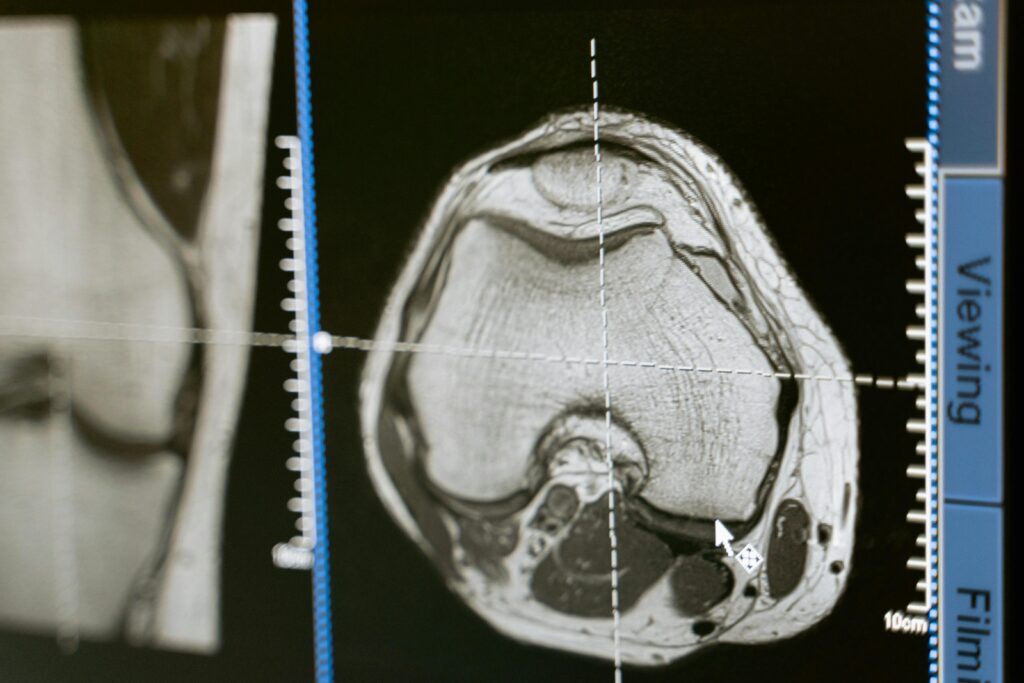 Brain scan