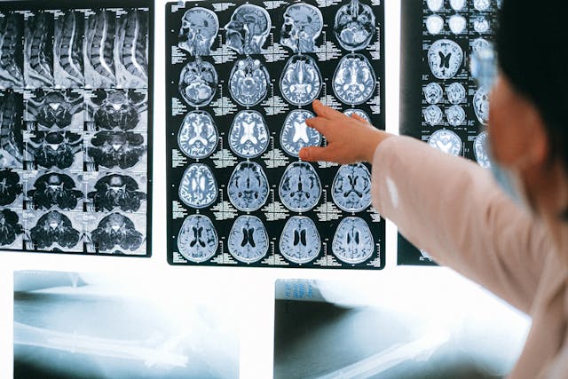 brain scan
