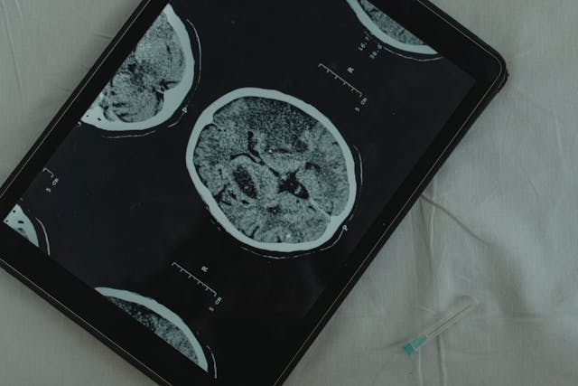 brain scan
