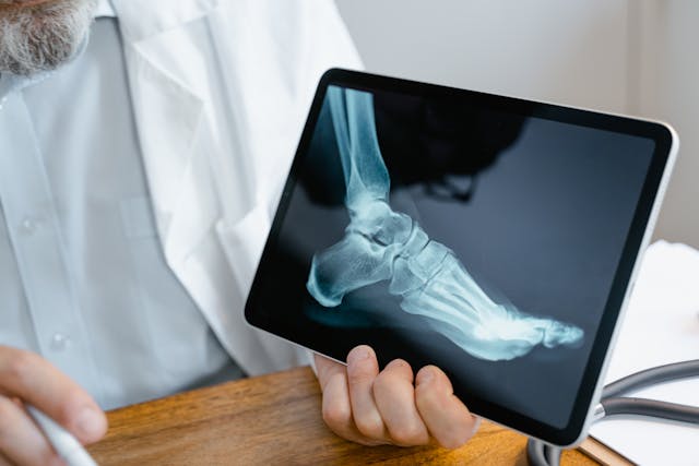 x-ray of a foot on a Dr's tablet