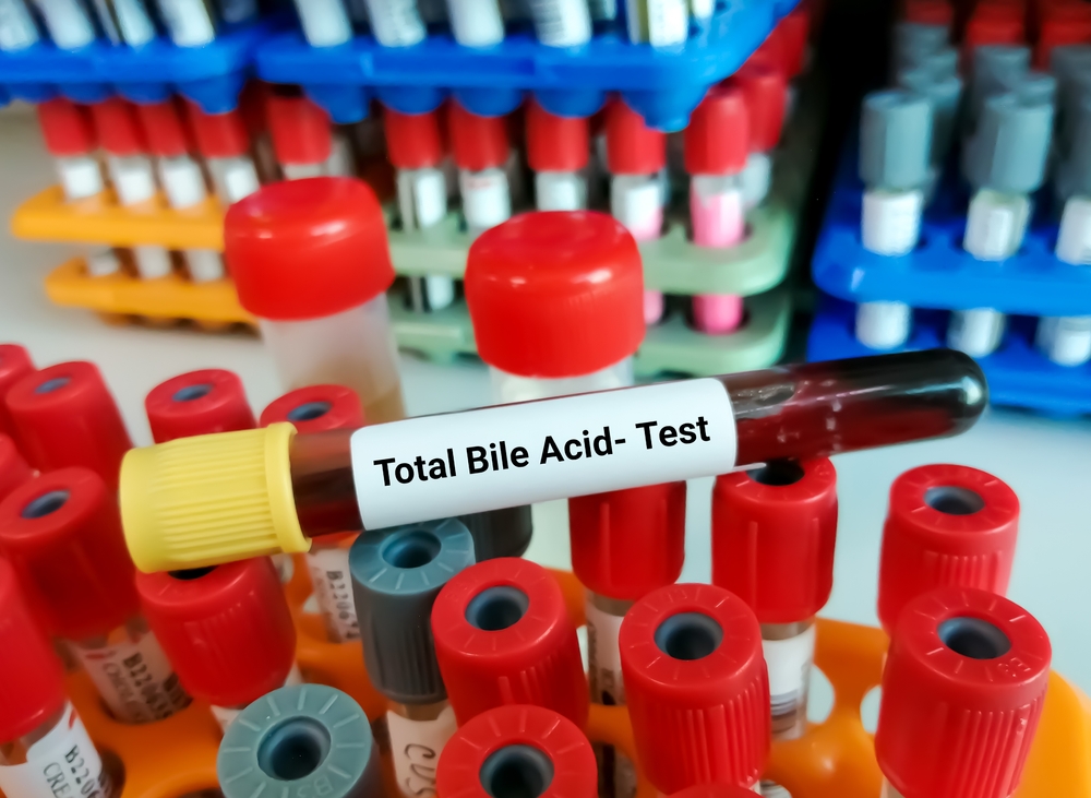Blood sample for Total Bile Acid (TBA) test