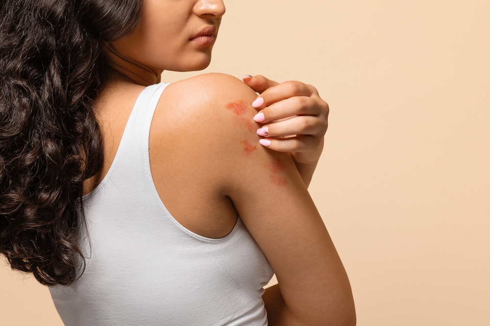 Unhappy young woman scratching her irritated skin on arm, annoyed indian female wearing white top suffering eczema or dermatitis, having itching rash on body, standing on beige studio background