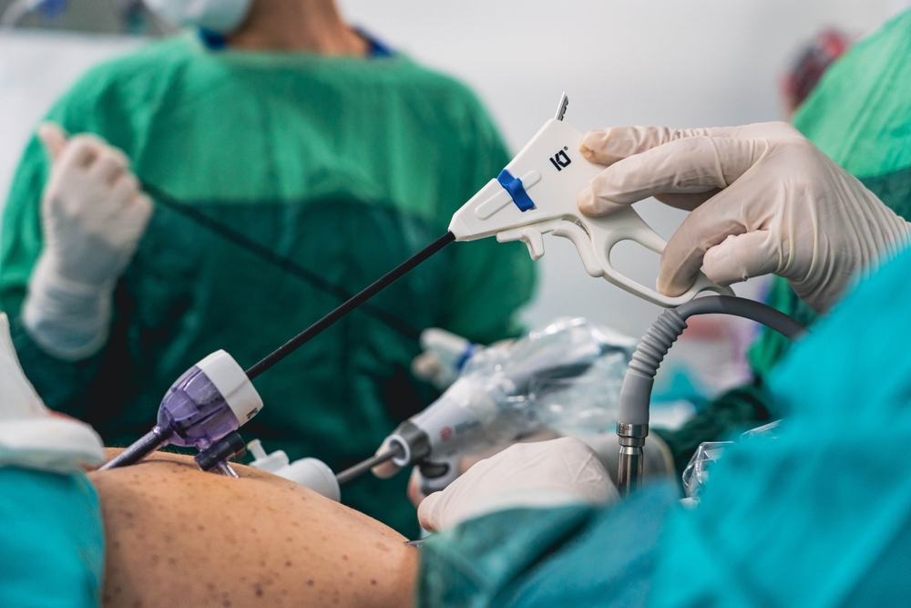 Laparoscopic Surgery, gastric sleeve, gastric bypass, hernia repair, gallbladder removal, sleeve gastrectomy, keyhole surgery, bariatric surgery, obesity surgery