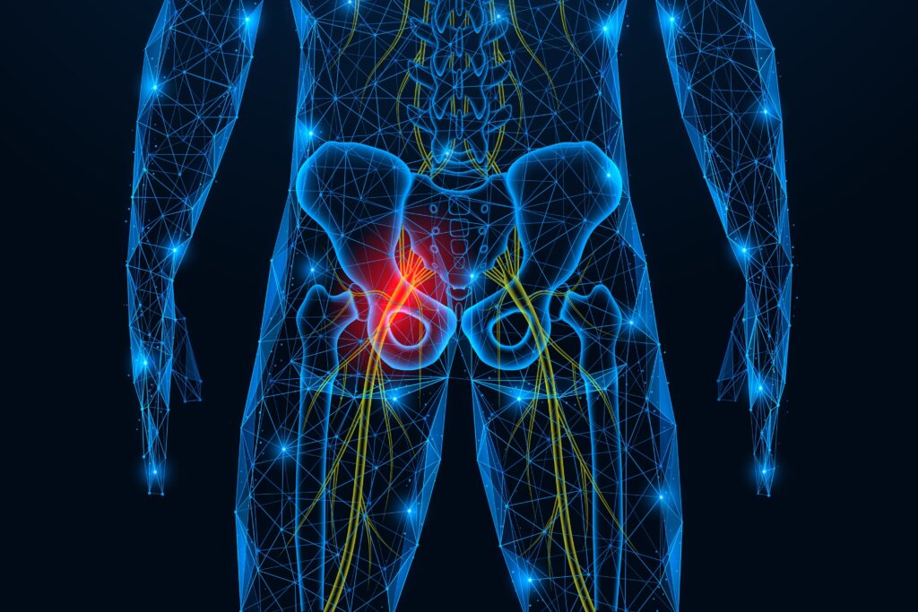 Inflammation of the sciatic nerve. Pain in the femoral area. Polygonal design of interconnected lines and dots. Blue background.