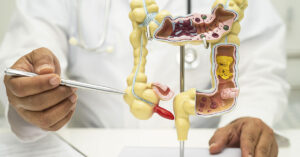 Doctor pointing to model f large intestine and appendix