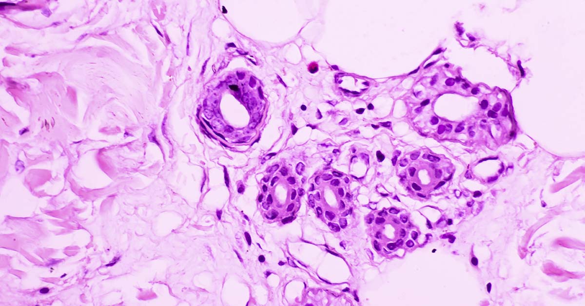 Respiratory Infections May Activate Dormant Cancer Cells