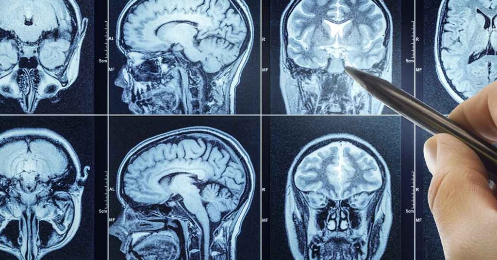 The Walking Dead Actress Kelley Mack Dies at 33 — What to Know About Her Rare Brain Cancer - Featured image