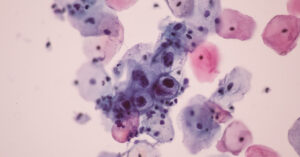 Infected 'Frankenstein' Rabbits With Tentacles Spotted in the US, Phenomena Explained 08112025_part03_44