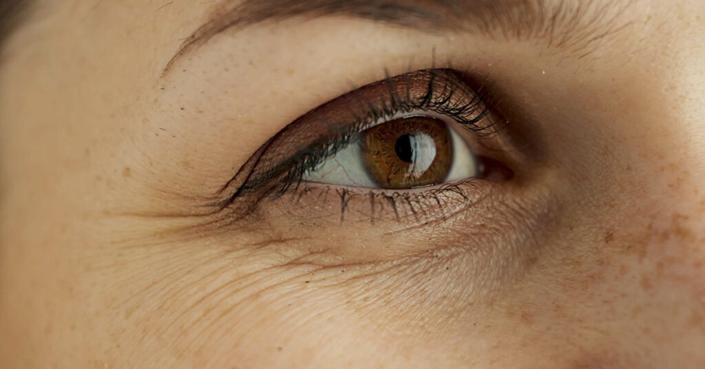 10 Easy Ways to Prevent Wrinkles – No Matter Your Age - Featured image