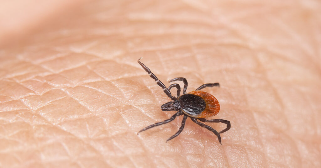 10+ Areas On Your Body Ticks Love To Bite - Featured image