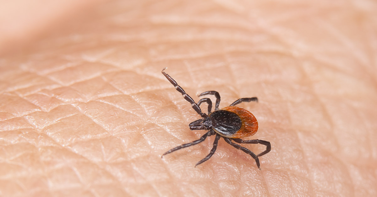 10+ Areas On Your Body Ticks Love To Bite