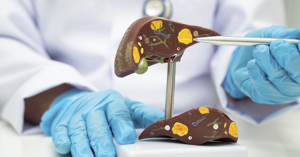 Harvard Doctor Recommends 4 Weekly Snacks to Combat Fatty Liver - Featured image