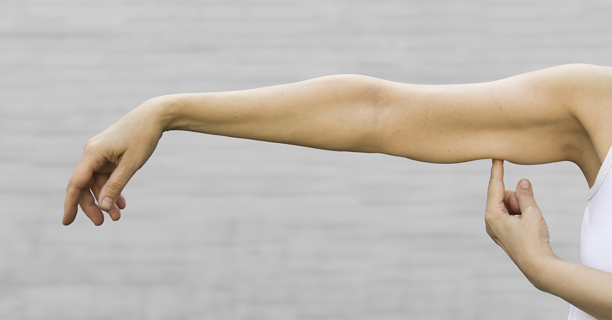 What Is Sarcopenia? Causes, Risk Factors, and How to Manage It