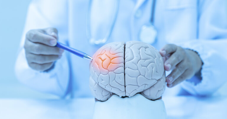 Stroke Myths That Put Lives at Risk, Know the Warning Signs to Stay Safe - Featured image