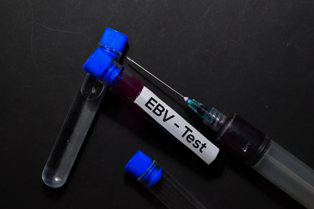 EBV - Test with blood sample. Top view isolated on office desk. Healthcare/Medical concept