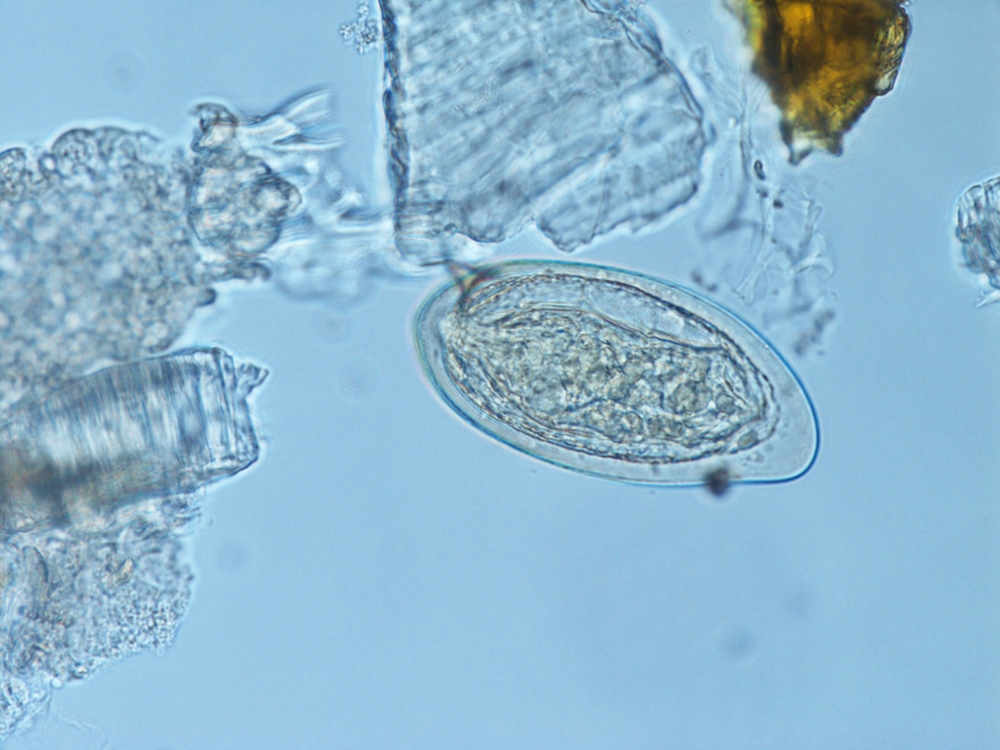 Trematodes, Schistosoma mansoni egg, schistosomiasis, blood flukes      