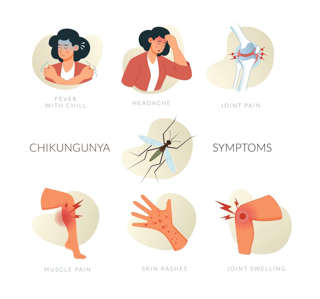 Illustrated Chikungunya Virus Symptoms with Fever and Joint Pain - Stock Iconas EPS 10 File
