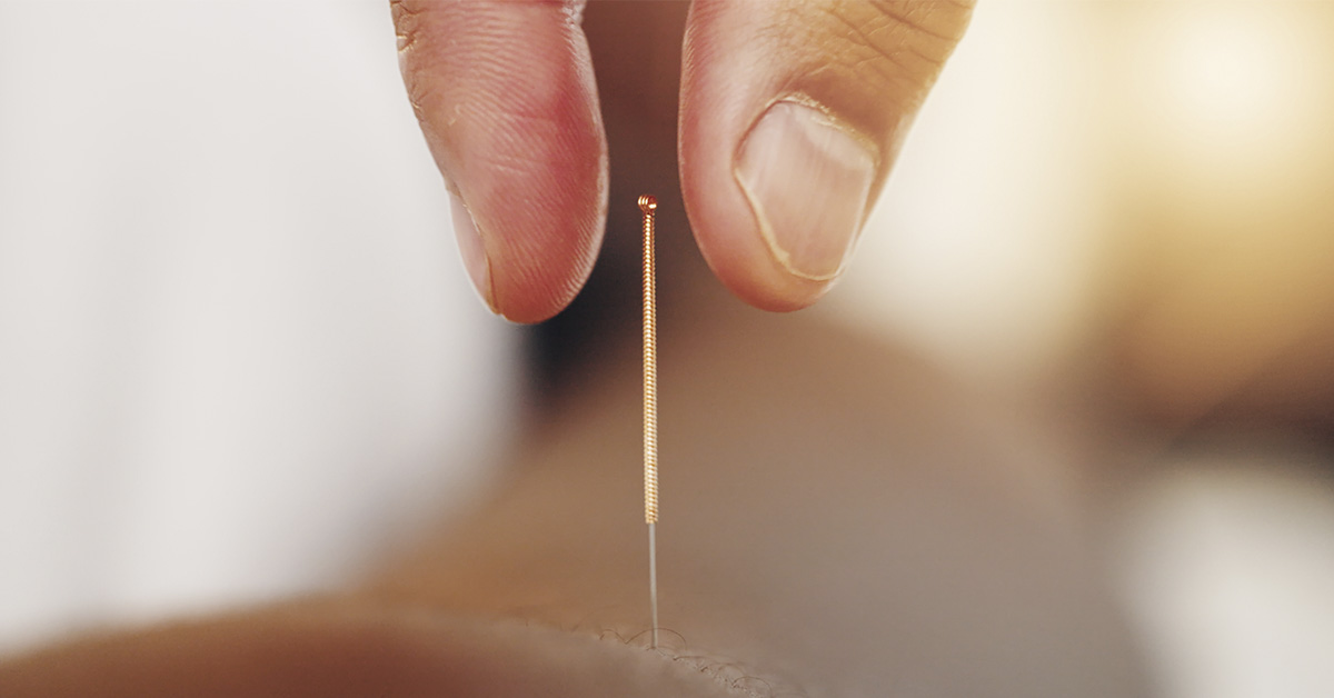 X-Ray Shows Hundreds of Gold Needles Embedded in Woman’s Knees