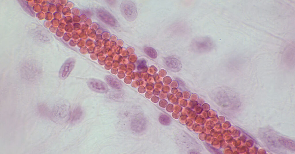 12 Foods That Could Help Reduce Blood Clot Risk (And Some to Avoid) - Featured image