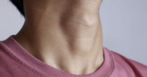 Your Adam’s Apple: What is it and Why Does Everyone Has One? close up of man's neck with large Adam’s apple