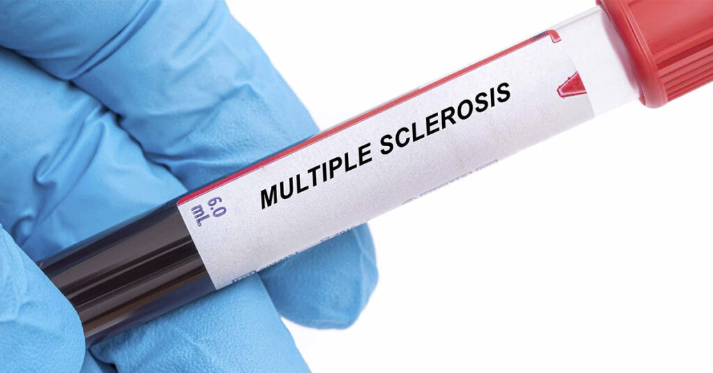 Study Points to Two Bacteria as Possible Causes for Multiple Sclerosis - Featured image