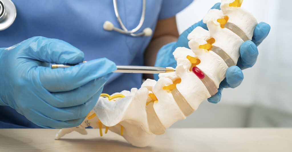 Brazilian Breakthrough Drug Shows Promise in Reversing Spinal Cord Injuries - Featured image