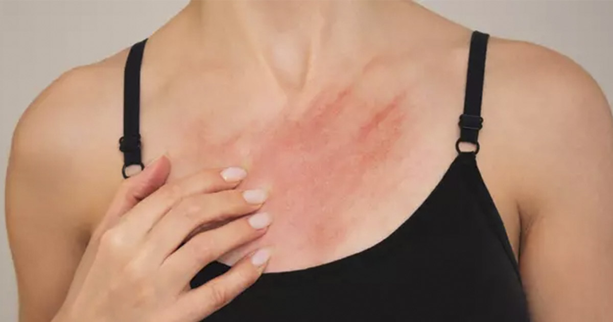 Funny breasts? Here are 6 Healthy issues that can be behind them