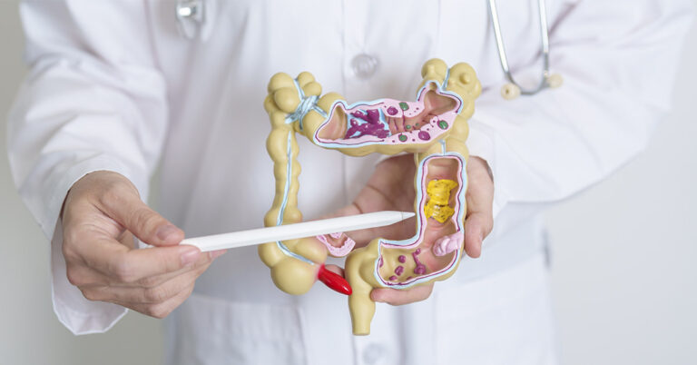 Doctor Warns Gen Z: ‘Silent’ Signs of Bowel Cancer May Go Unnoticed as Cases Rise - Featured image