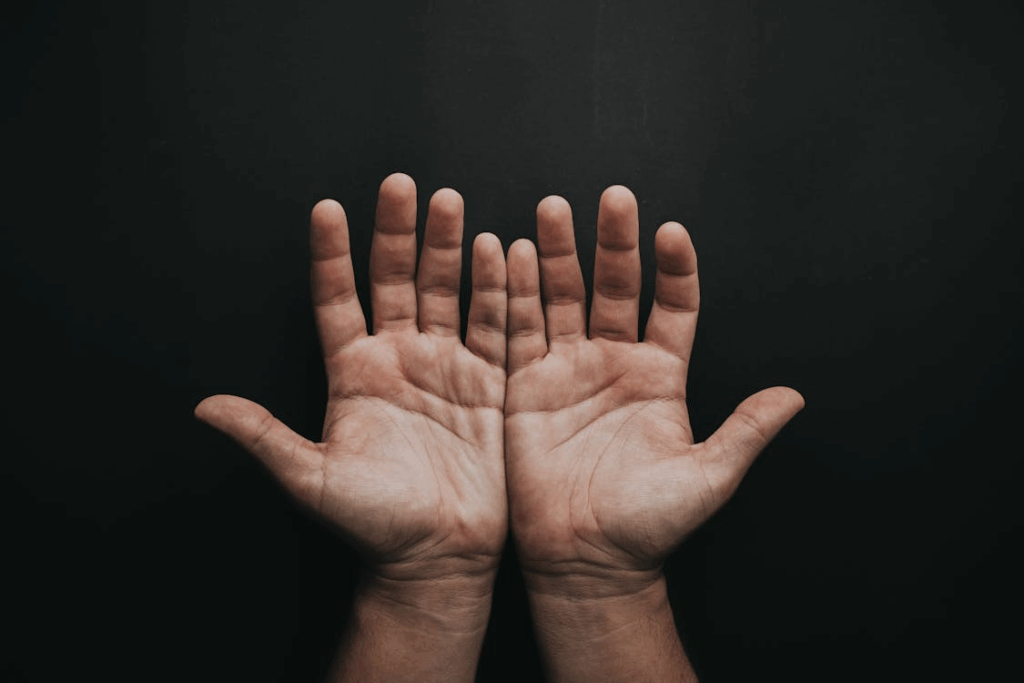 Photo Of Person's Open Hands Clogged Arteries