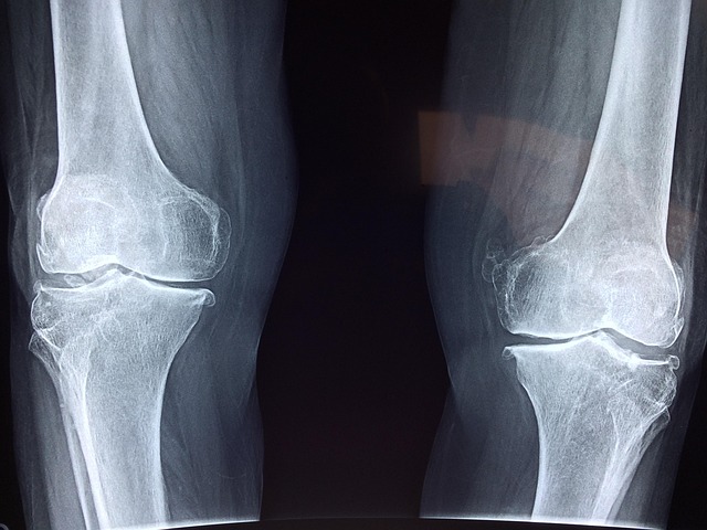 x-ray of knee joints