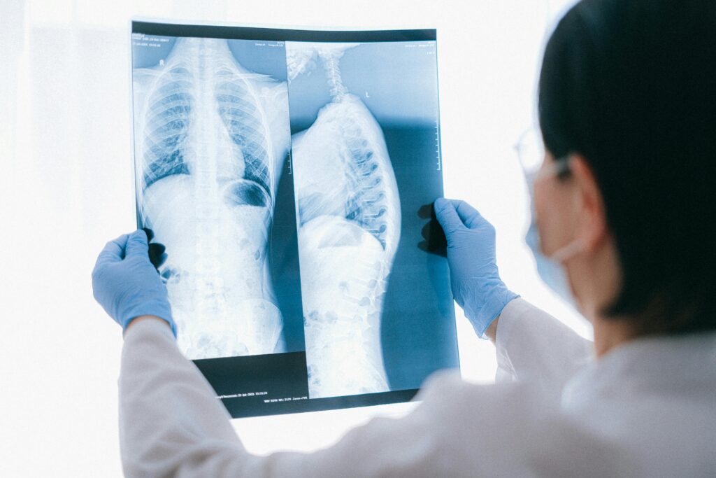 doctor with lung damage x-rays