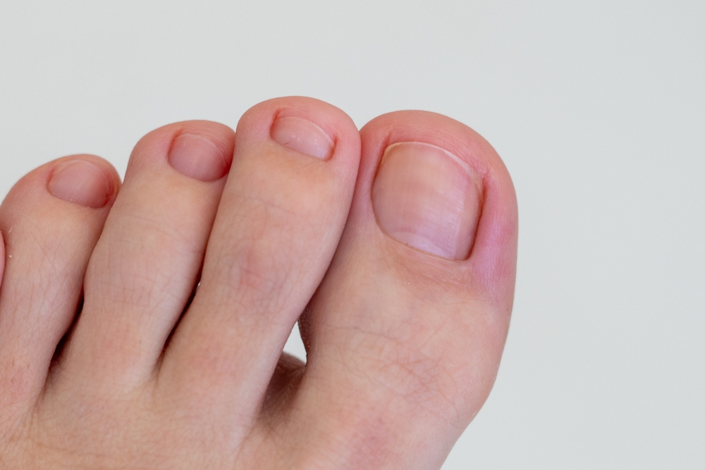 Closeup of female feet and toes. Healthy feet concept