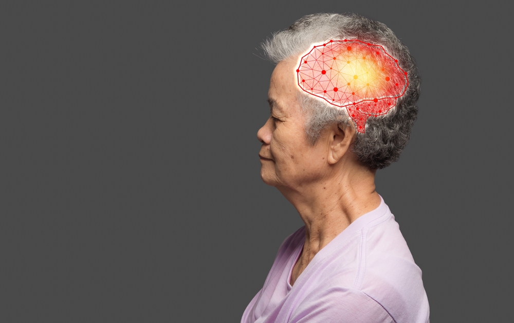 Dementia in the elderly. Memory impairment. Alzheimer's, Parkinson's, stroke, seizure, and mental health awareness. Care for Neurology and Psychology. Concept of Science and Medicine