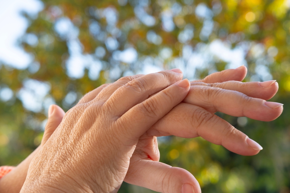 closeup female hands 55 years old with dry skin damage, applying moisturizer, concept beauty and skincare in second half life, treatment dermatological diseases, hydration and nutrition of epidermis