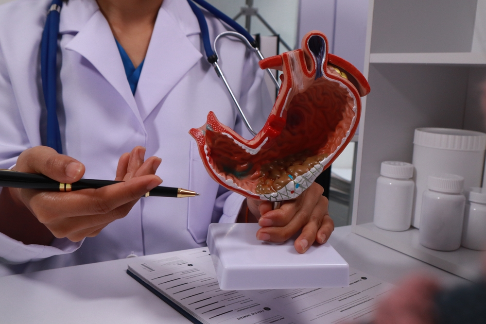 The doctor explained gastritis using a model. Treatment options were discussed. Understanding the condition better helps in managing it effectively.