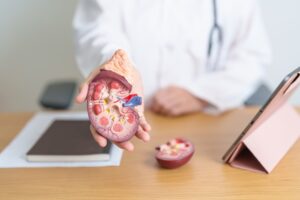 Doctor,With,Kidney,Adrenal,Gland,Anatomy,Model,And,Tablet.,Disease