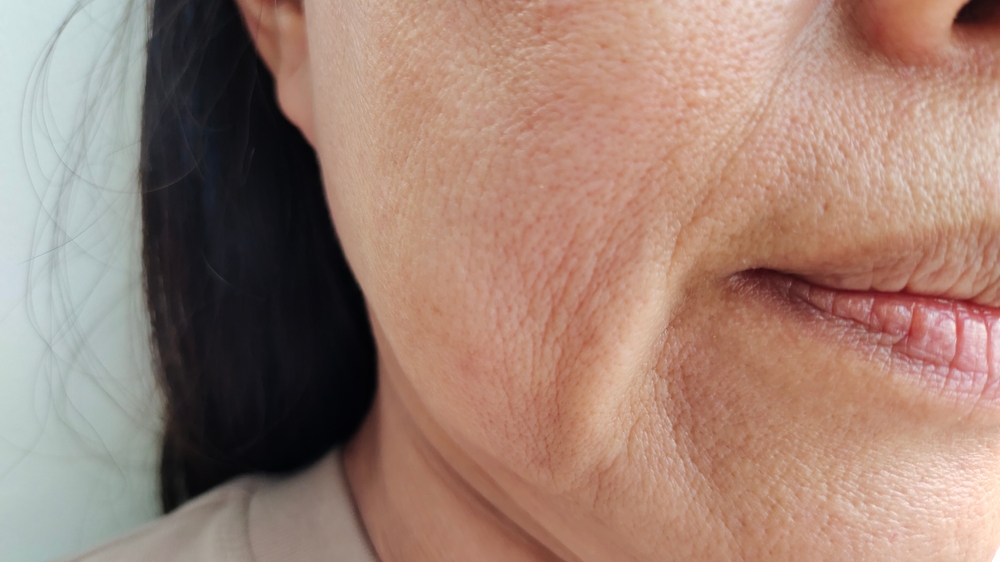 portrait the wrinkle and Flabby skin beside the mouth, dark spots and blemish, scar and freckles, wrinkled and loose on the face of middle aged women 55 years old, health care and beauty concept.