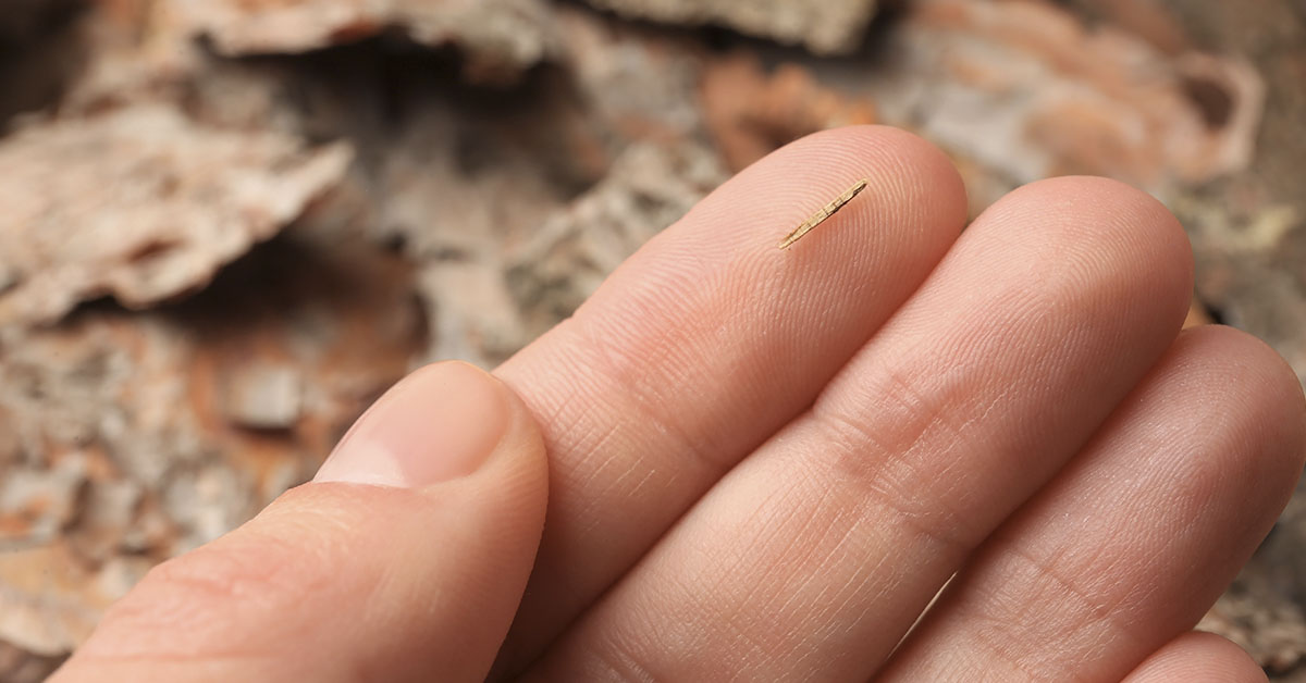 9 Easy At-Home Methods to Remove Splinters Safely