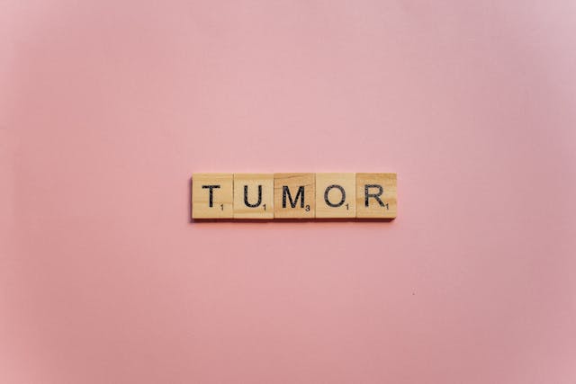 tumor scrabble letters